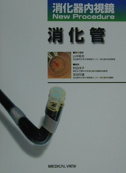 消化器内視鏡new　procedure（消化管）