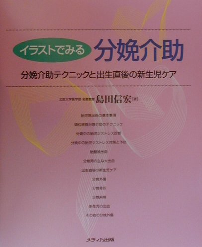 イラストでみる分娩介助