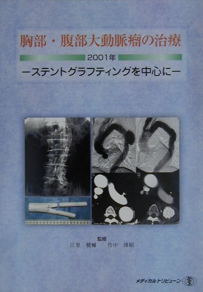 本書は、大動脈瘤疾患の治療の我が国における現況、特にステントグラフト内挿術を中心とした内容になっており、実戦に即した具体的なものとなっている。