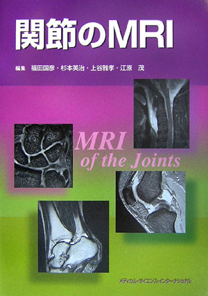 関節のMRI