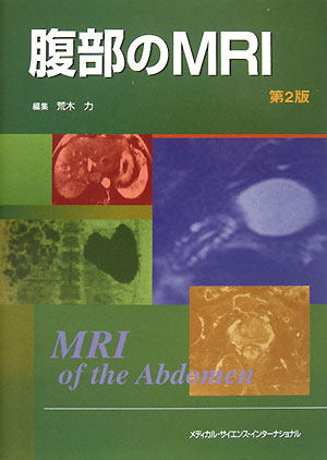 腹部のMRI第2版