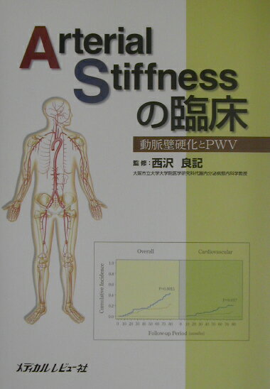 Arterial　stiffnessの臨床 動脈壁硬化とPWV [ 西沢良記 ]