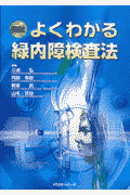 図説よくわかる緑内障検査法