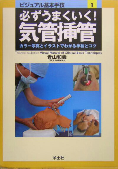 必ずうまくいく！気管挿管