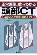 正常画像と並べてわかる頭部CT