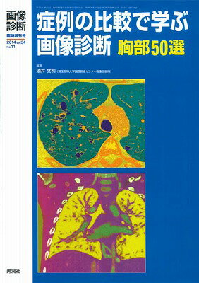画像診断　14年臨時増刊号（34-11）