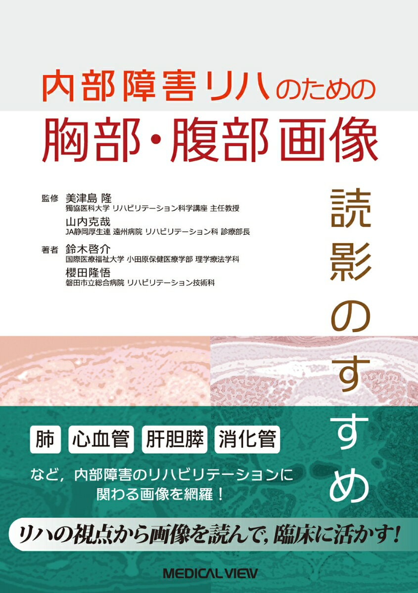 肺、心血管、肝胆膵、消化管など、内部障害のリハビリテーションに関わる画像を網羅！リハの視点から画像を読んで、臨床に活かす！