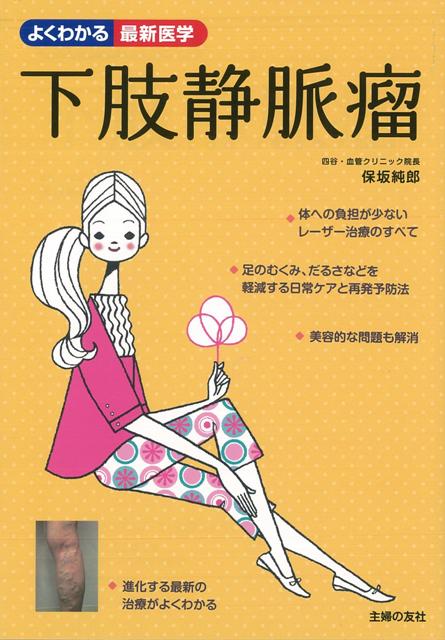 【バーゲン本】下肢静脈瘤ーよくわかる最新医学