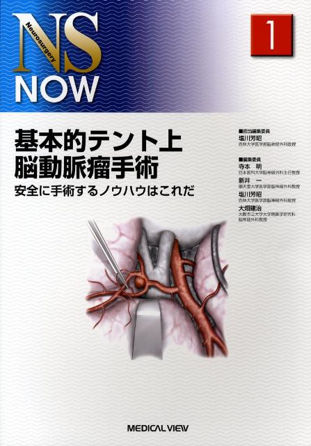 基本的テント上脳動脈瘤手術