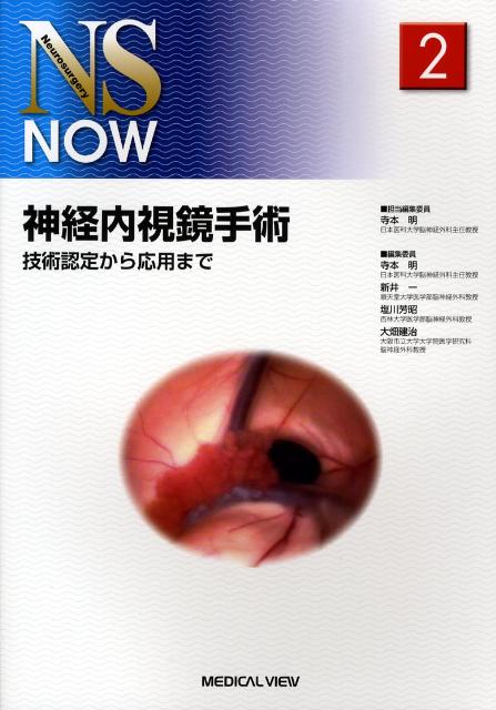 神経内視鏡手術