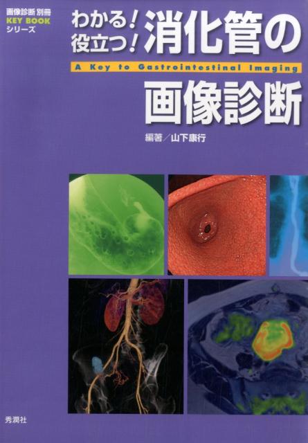 わかる!役立つ!消化管の画像診断