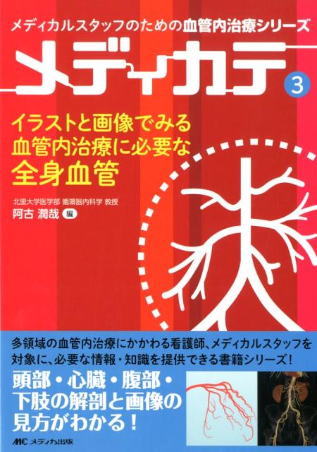 イラストと画像でみる血管内治療に必要な全身血管 （メディカルスタッフのための血管内治療シリーズ　メディカテ3） [ 阿古 潤哉 ]