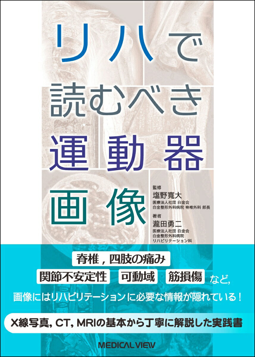 脊椎、四肢の痛み、関節不安定性、可動域、筋損傷など、画像にはリハビリテーションに必要な情報が隠れている。Ｘ線写真、ＣＴ、ＭＲＩの基本から丁寧に解説した実践書。