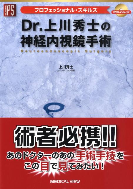 Dr．上川秀士の神経内視鏡手術