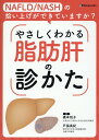 NAFLD／NASHの拾い上げができていますか？やさしくわかる脂肪肝の診かた 橋本悦子