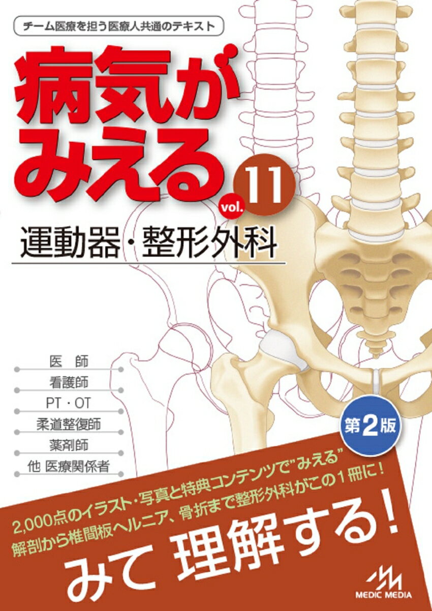 病気がみえる（vol.11） 運動器・整形外科 [ 医療情報科学研究所 ]