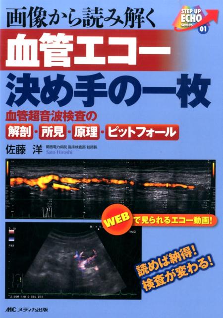 画像から読み解く血管エコー決め手の一枚