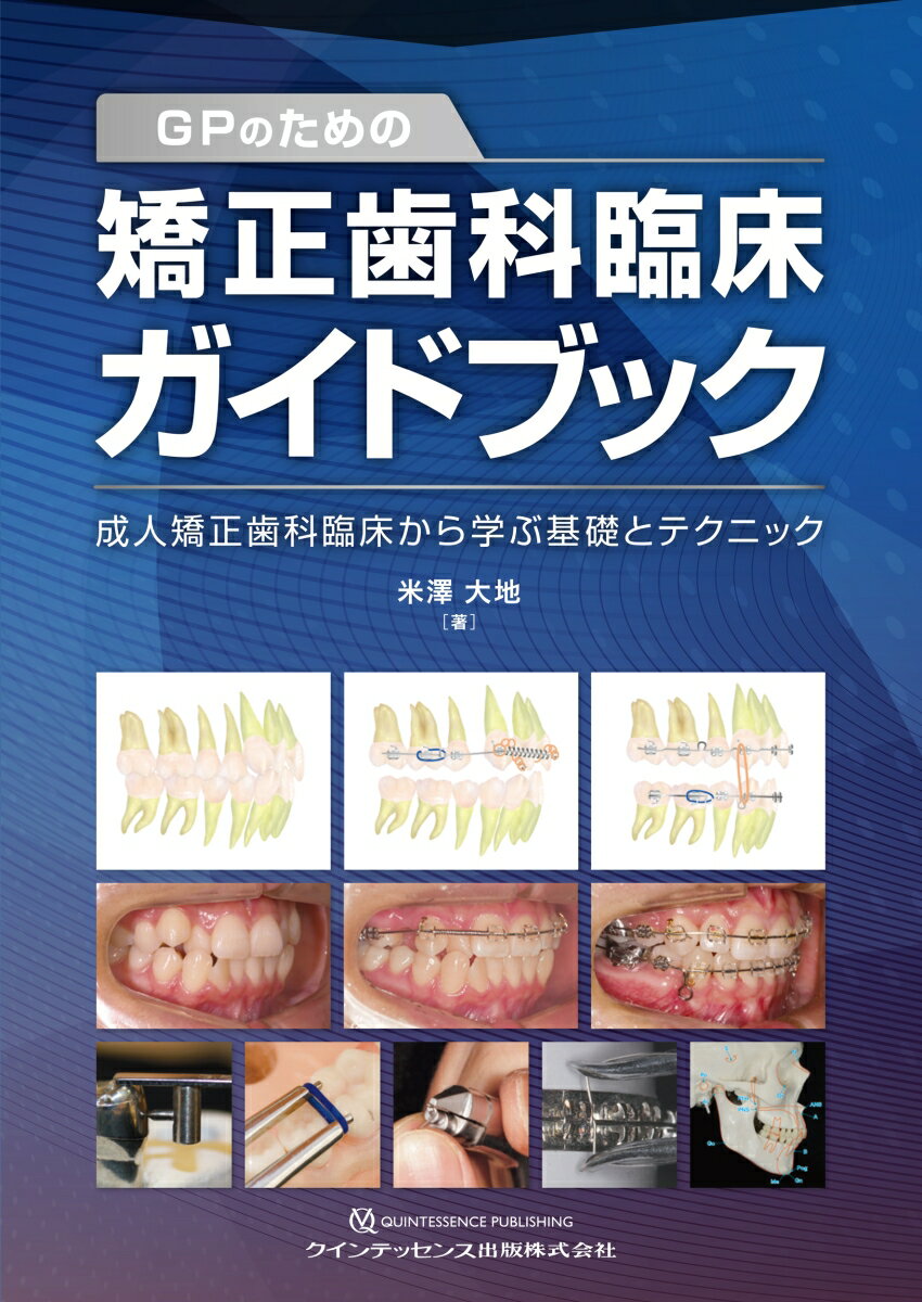 GPのための矯正歯科臨床ガイドブック 成人矯正歯科臨床から学ぶ基礎とテクニック [ 米澤大地 ]