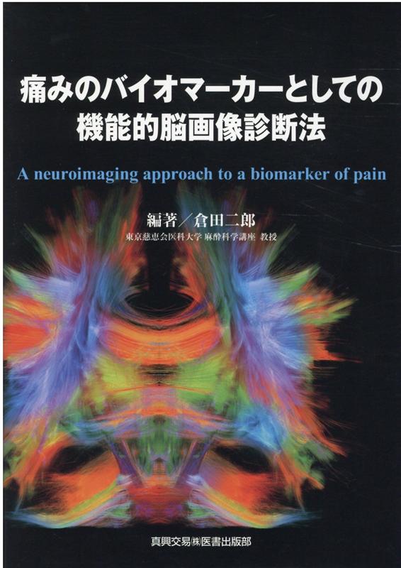 痛みのバイオマーカーとしての 機能的脳画像診断法
