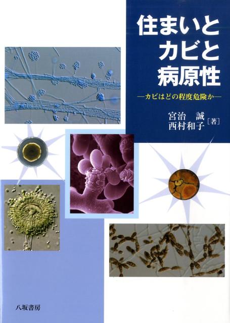 日本の医真菌学会をリードしてきた２人の巨頭が繰り出す、住環境を汚染するカビのもっとも詳しい解説書。身近に生きている主な環境真菌１２０種余りの生態・性状・病原性、危険度・病原度などを詳述。さらに、今後危惧される輸入感染症とその病因菌を紹介。人体の各臓器から分離された菌の一覧表付き。