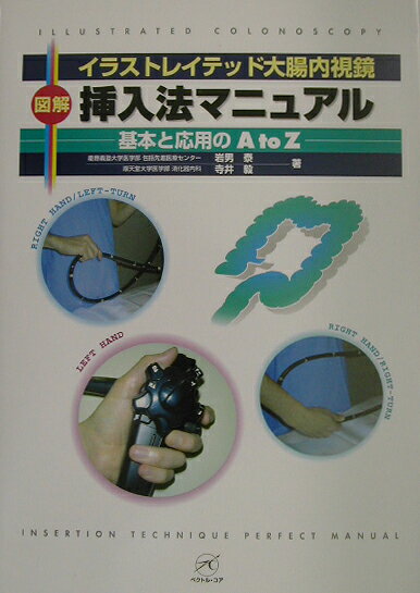 イラストレイテッド大腸内視鏡図解挿入法マニュアル