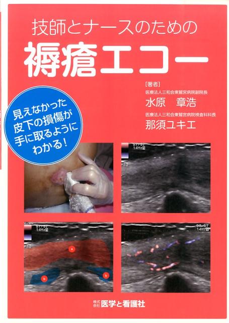 技師とナースのための褥瘡エコー