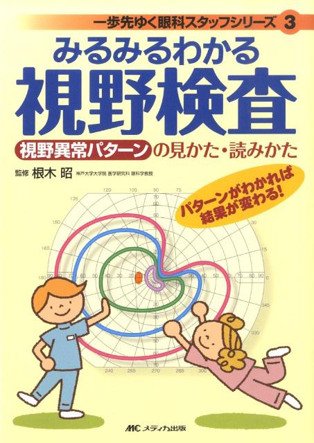 みるみるわかる視野検査