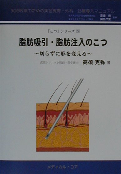 脂肪吸引・脂肪注入のこつ