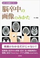 苦手な方の多い脳卒中の画像検査の知識ですが、本書では脳画像を７つのパターンに絞って、その読み方をシンプルに解説。脳の中で何が起こり、それが目の前の症状とどうつながっているのかが分かります。