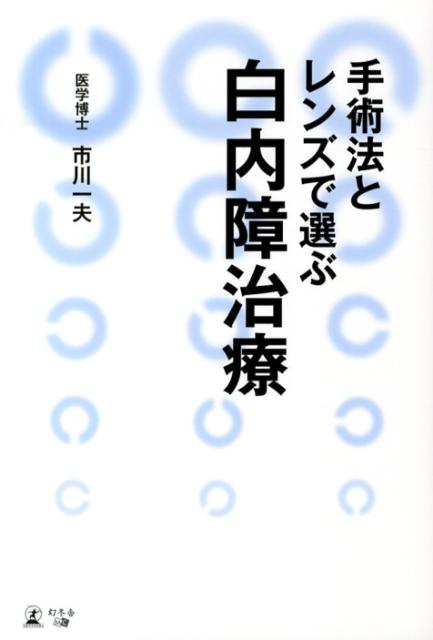 手術法とレンズで選ぶ白内障治療