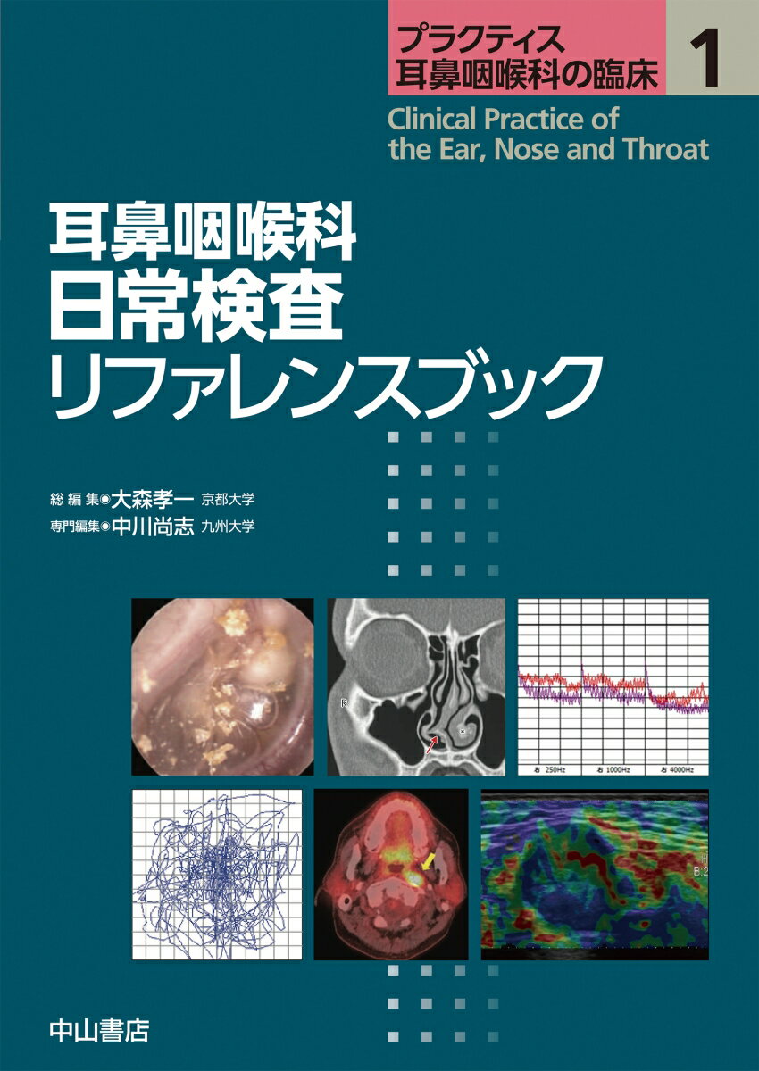 耳鼻咽喉科 日常検査リファレンスブック（第1巻）