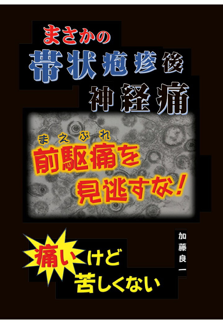 【POD】まさかの帯状疱疹後神経痛 前駆痛を見逃すな！