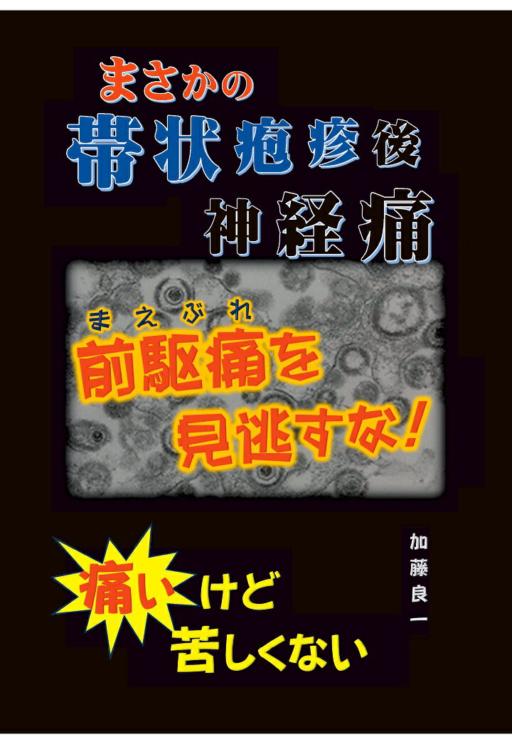 【POD】まさかの帯状疱疹後神経痛 前駆痛を見逃すな！