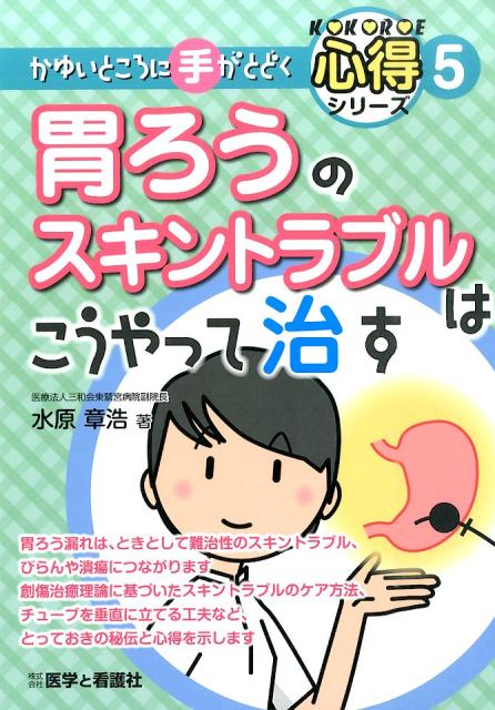 胃ろうのスキントラブルはこうやって治す