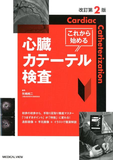 初歩の初歩から、手取り足取り徹底マスター。「つまずきポイント」が「特技」に変わる！造影画像＋手元画像＋イラストで簡潔解説。心臓カテーテル検査をはじめて行うときに役立つ基礎知識とテクニックが満載。術前術後の予習復習にも対応、レポート作成時にも必携！