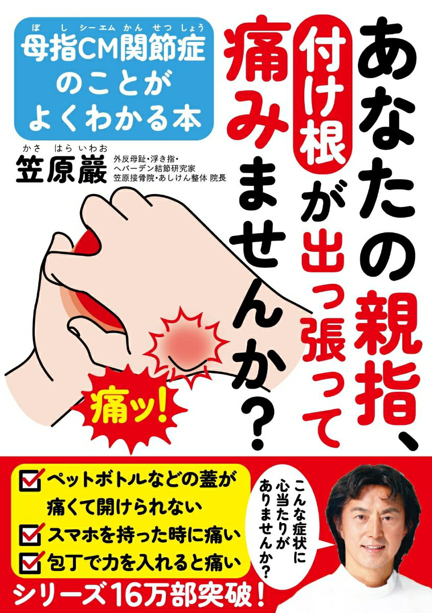 母指CM関節症のことがよくわかる本 笠原 巖 自由国民社アナタノオヤユビツケネガデッパッテイタミマセンカ カサハラ イワオ 発行年月：2023年12月12日 予約締切日：2023年11月10日 ページ数：120p サイズ：単行本 ISBN：9784426129583 笠原巖（カサハライワオ） 外反母趾・浮き指・ヘバーデン結節研究家、笠原接骨院（あしけん整体）院長、過労性構造体医学（Gバランス医療）創始者。これまでの50年に及び初検だけで12万人以上の足をみる。外反母趾・浮き指・扁平足、「仮称：足ヘバーデン」などの不安定な足が引き起こす、足の痛み、ひざ痛、股関節痛、腰痛、肩こり、首こり、自律神経失調状態、うつ状態などに対し、重力とのバランスで力学的に解明し、“足から未病”を改善。その普及を目指し、全国で多くの講演やスクールを行っている。テレビ・新聞などのマスコミでも活躍中（本データはこの書籍が刊行された当時に掲載されていたものです） はじめに　「母指CM関節症」の有無からあなたの未来の健康状態が見える／第1章　「母指CM関節症」はなぜ治らないのか？／第2章　「母指CM関節症」は自分で治せる！／第3章　「ヘバーデン結節」が関係する40歳からの「手」の痛みと変形／第4章　「ヘバーデン結節」が関係する40歳からの「足」の痛みと変形／第5章　「ヘバーデン結節」が関係する40歳からの全身の痛みと変形／第6章　「重力とのバランス」を整え「90％の固定」が治療の大原則／おわりに　ヘバーデン結節は世界共通、万人の問題 本 美容・暮らし・健康・料理 健康 家庭の医学