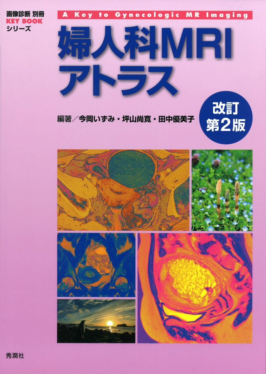 楽天楽天ブックス婦人科MRIアトラス　改訂第2版 （画像診断　別冊KEY　BOOKシリーズ） [ 今岡いずみ ]