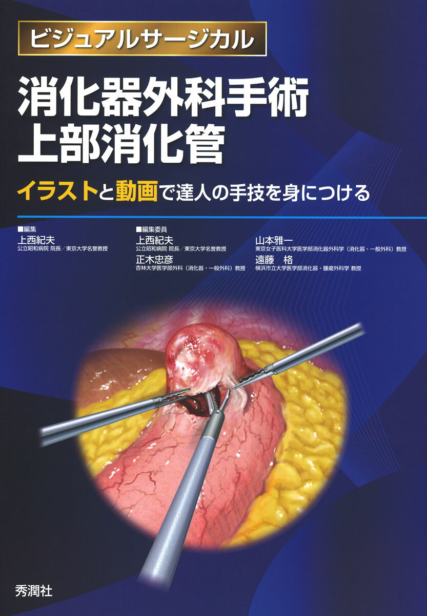消化器外科手術　上部消化管