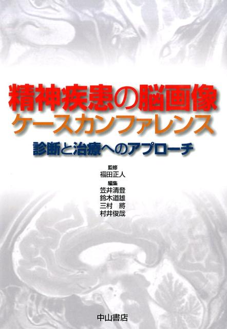 精神疾患の脳画像ケースカンファレンス