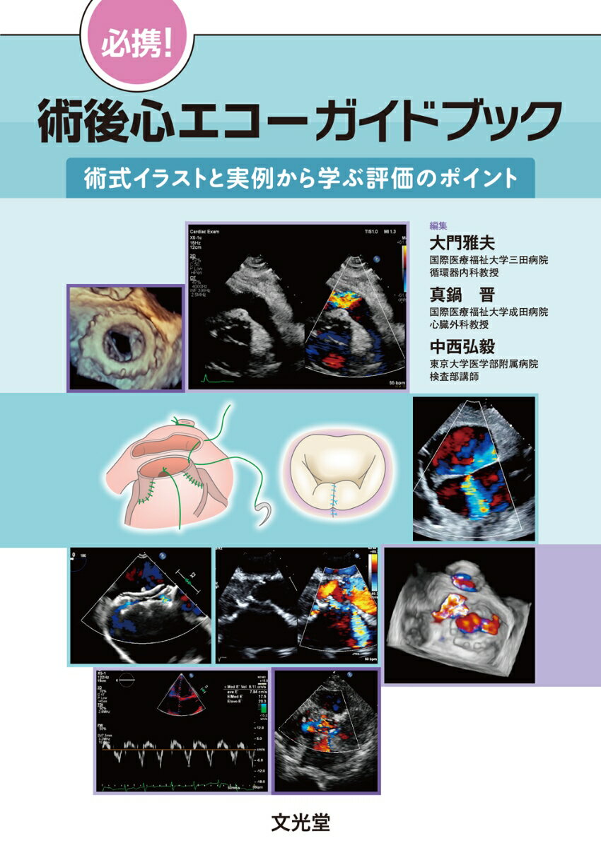 必携！術後心エコーガイドブック　術式イラストと実例から学ぶ評価のポイント [ 大門　雅夫 ]