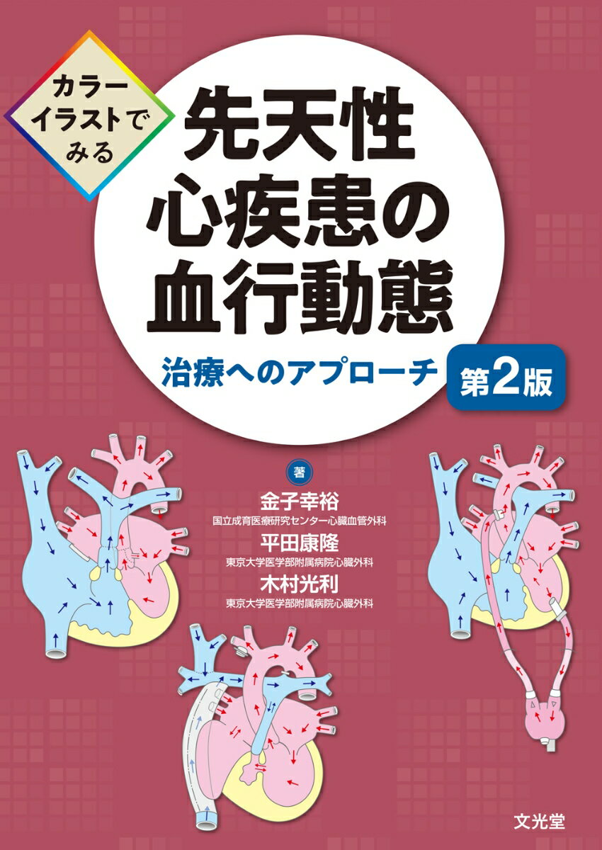 カラーイラストでみる　先天性心疾患の血行動態 第2版　治療へのアプローチ [ 金子　幸裕 ]