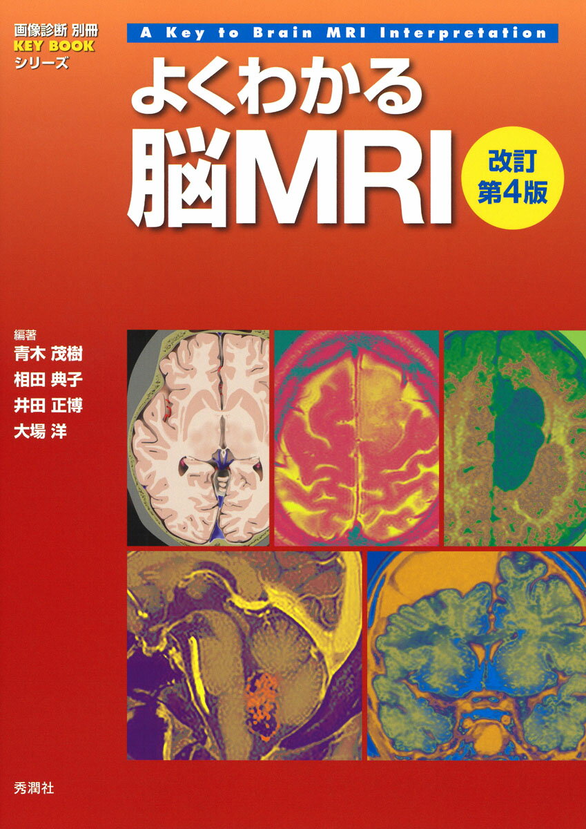 よくわかる脳MRI　改訂第4版 （画像診断別冊KEYBOOKシリーズ） [ 青木茂樹 ]