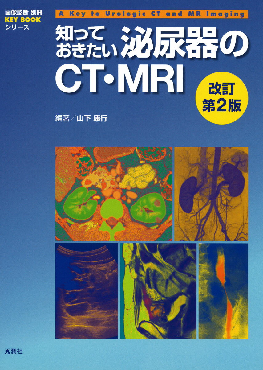 知っておきたい泌尿器のCT MRI 改訂第2版 （画像診断別冊KEY BOOKシリーズ） 山下康行