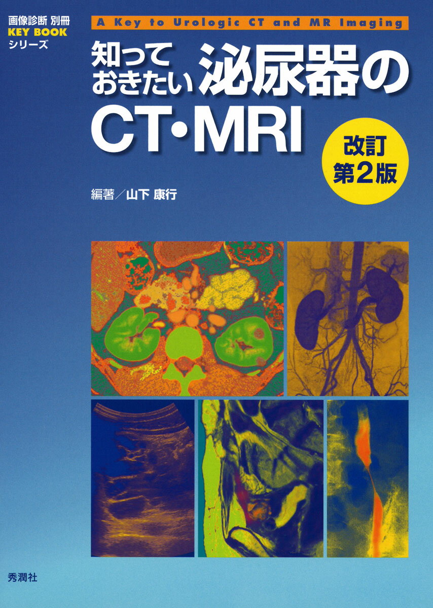 知っておきたい泌尿器のCT・MRI 改訂第2版