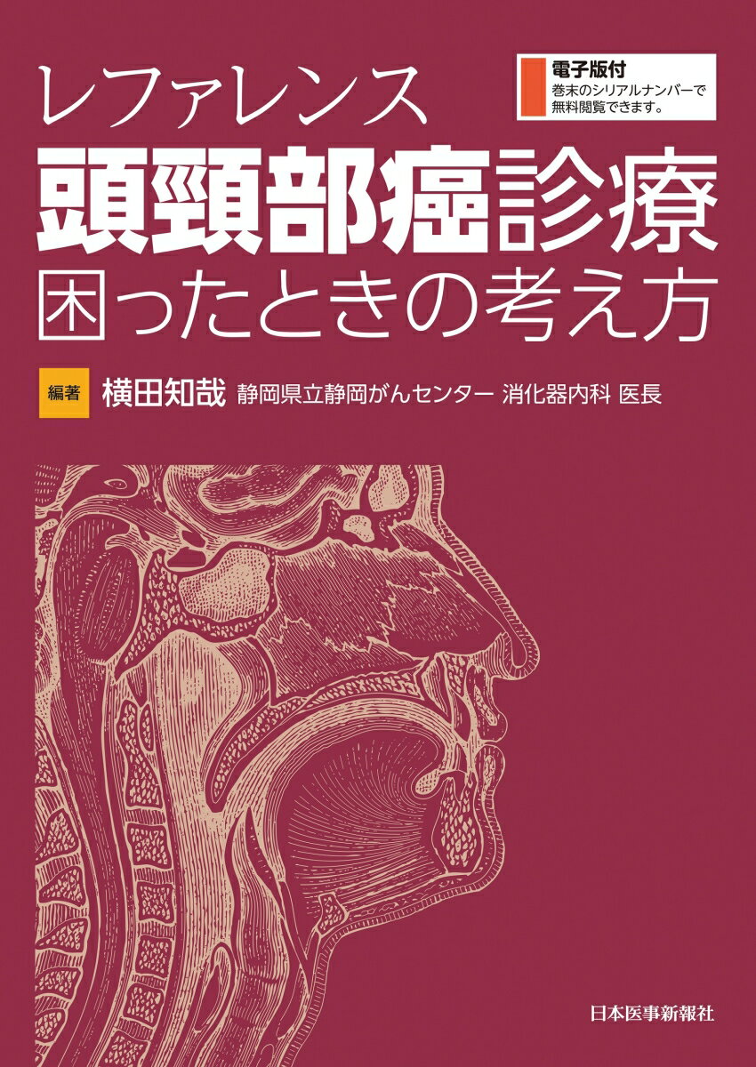 レファレンス 頭頸部癌診療 困ったときの考え方