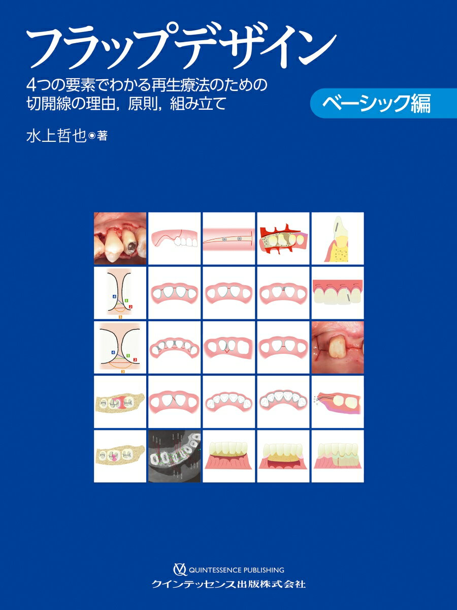 フラップデザイン ベーシック編 4つの要素でわかる再生療法のための切開線の理由，原則，組み立て [ 水上哲也 ]