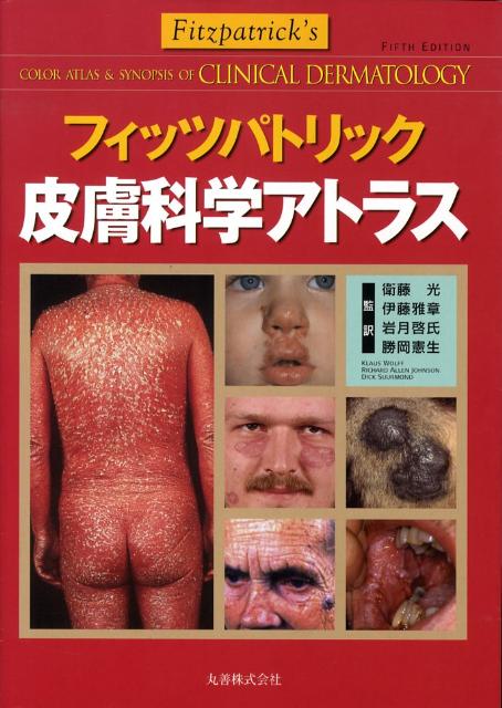 フィッツパトリック皮膚科学アトラス