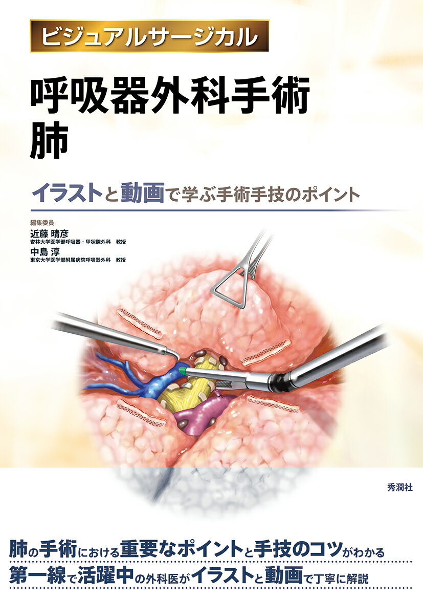 呼吸器外科手術 肺