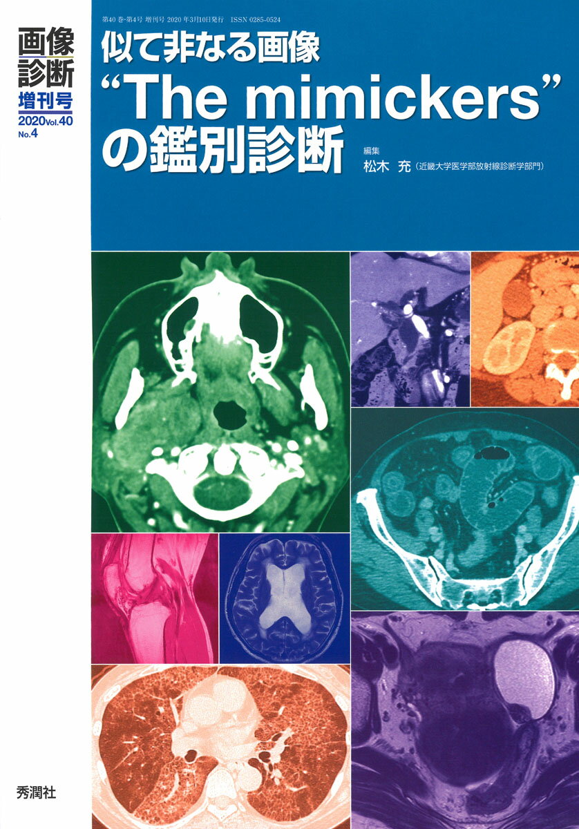 画像診断2020年増刊号（Vol．40 No．4）