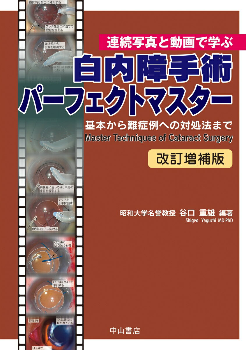 楽天楽天ブックス連続写真と動画で学ぶ　白内障手術パーフェクトマスター　基本から難症例への対処法まで [ 谷口重雄 ]